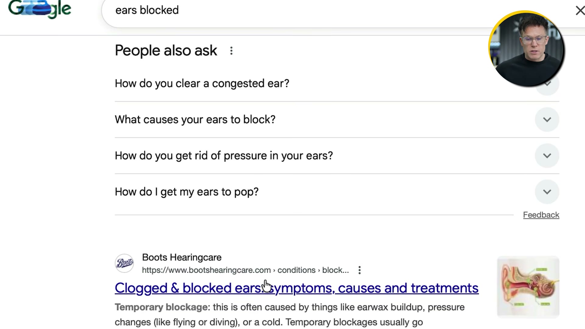 Google's 'ears blocked' SERP shows how Boots Hearingcare captures high-volume informational queries with targeted condition content.