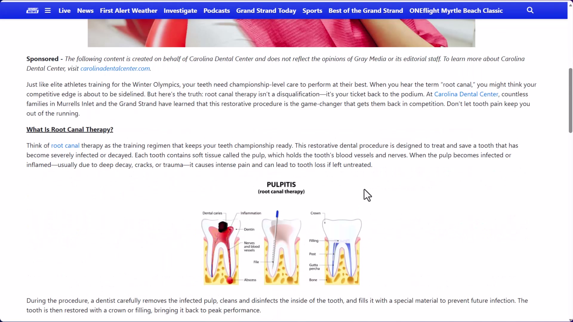 Carolina Dental Center sponsors educational content on a local TV news site — a content marketing tactic that builds authority, earns backlinks, and reaches a local audience actively reading health news.